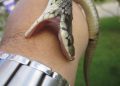 What Are Snake Bites?