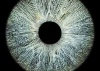 What Is Neovascularization Of The Eye