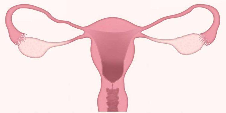 What Is Unicornuate Uterus